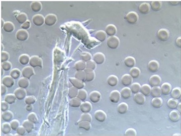 Megszólalnak a vércseppek!