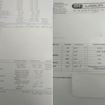 Előtte-utána pajzsmirigy labor