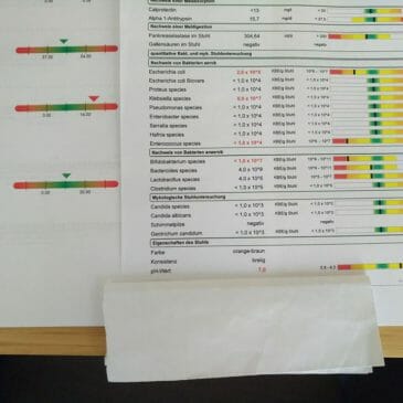 Krónikus ízületi gyulladás vizsgálata