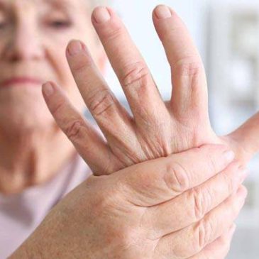 Diétás szempontok a krónikus ízületi gyulladásos betegek kezelésében